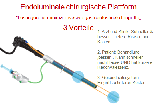 Endoluminale-chirurgische-Plattform-hat-3-Vorteile